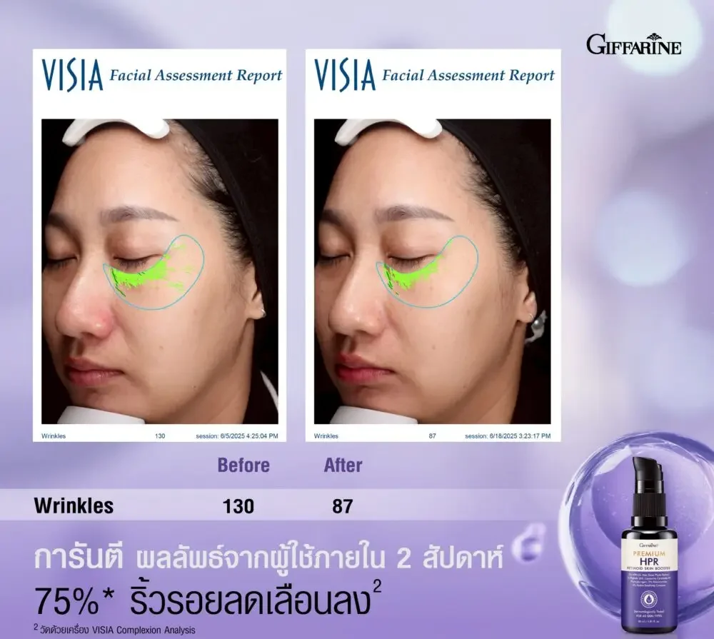 576862991_1244838517678536_5845981293734301848_n