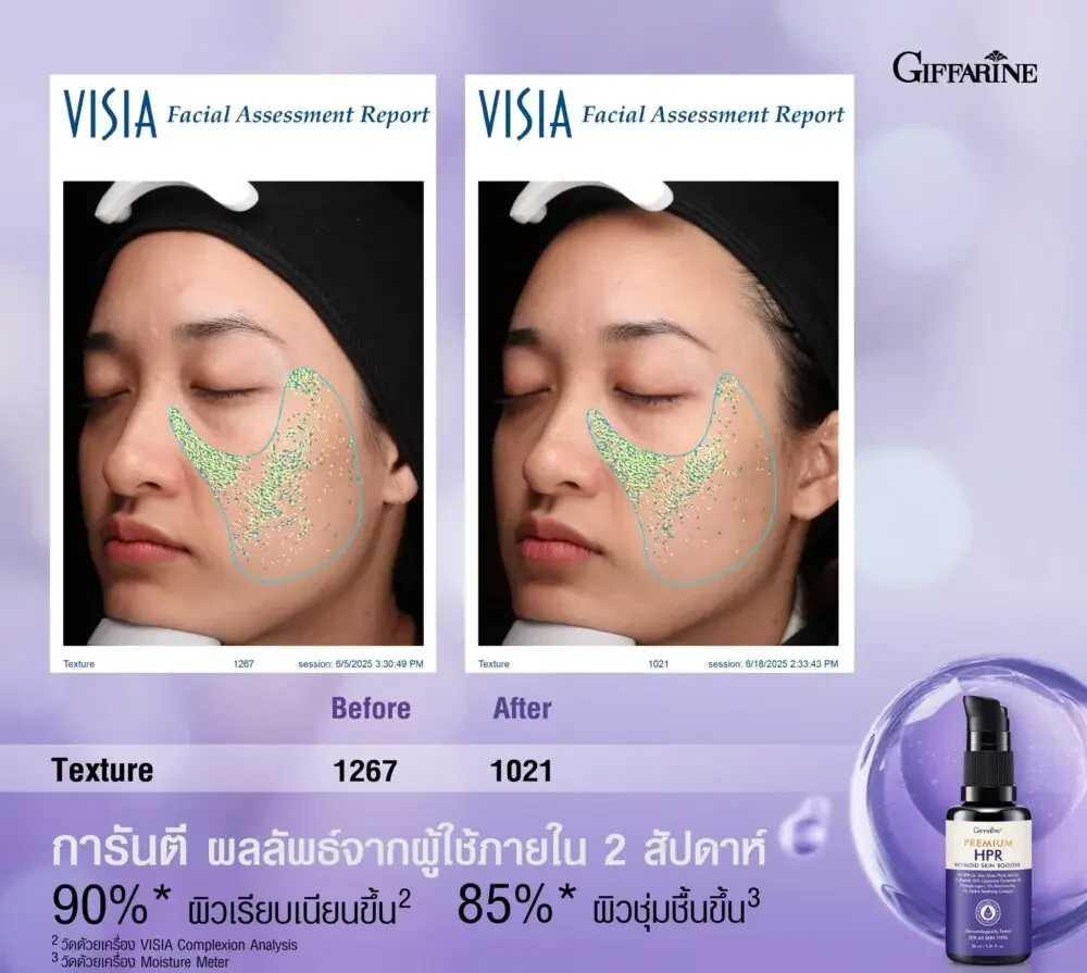 576885705_1244838607678527_5488350192452284697_n